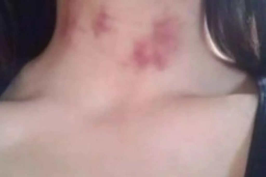 Lobisomem visita esposa
